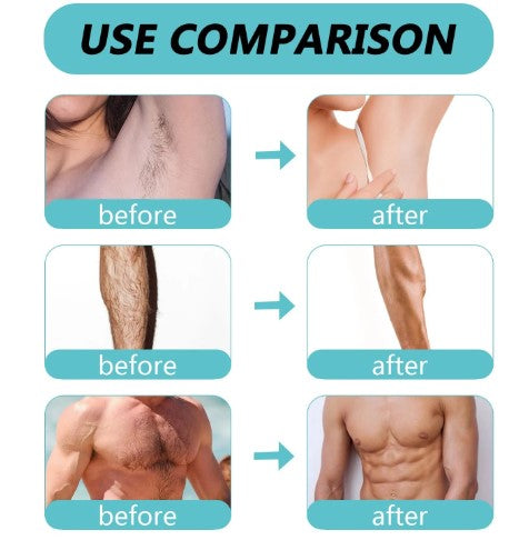 Ecrin Hair Removal Foaming Spray